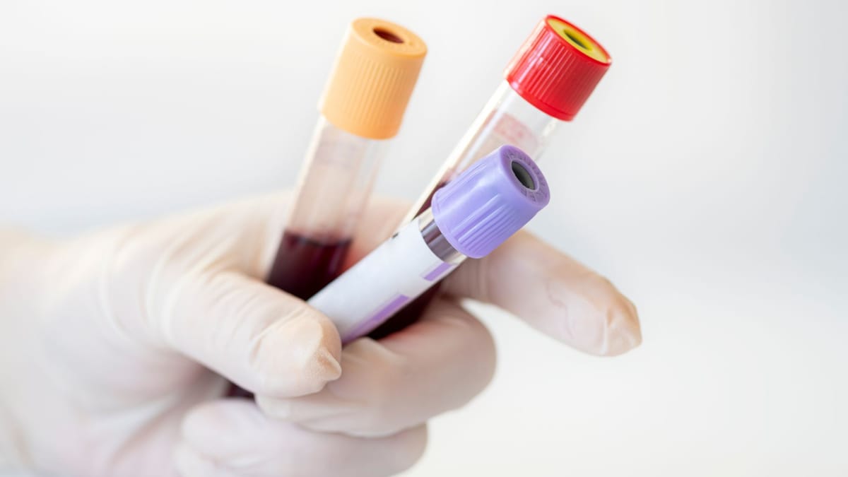 Integrativ / alternativ tibbiyot, nutritsiologlar va “keraksiz” analizlar