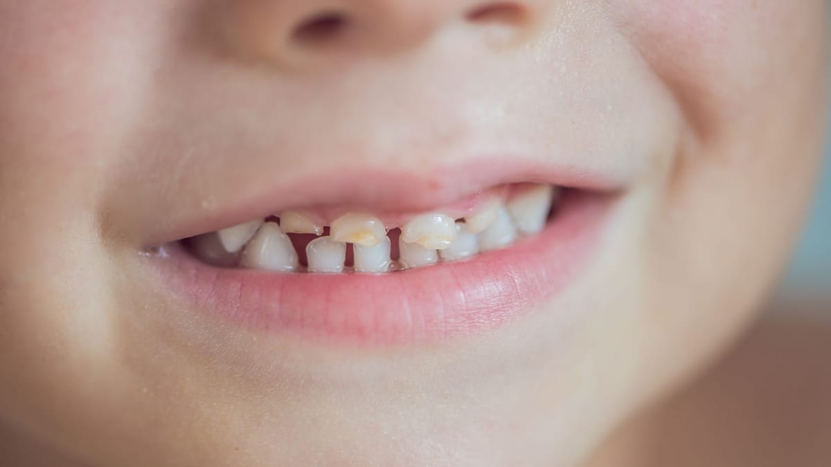 Yuz belgilariga qarab prikusni baholash (stomatologiya)