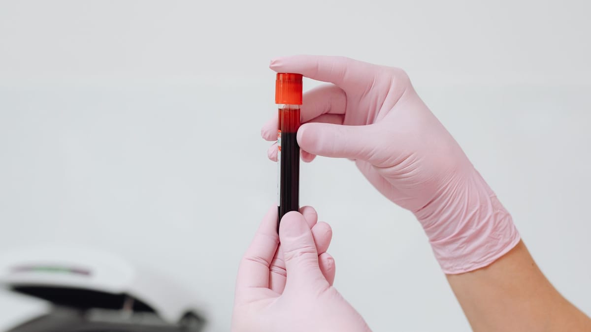 TTG skriningi: barcha bolalar uchun shartmi?