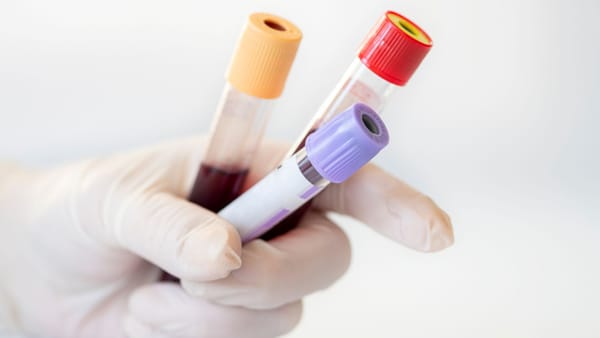 Integrativ / alternativ tibbiyot, nutritsiologlar va “keraksiz” analizlar