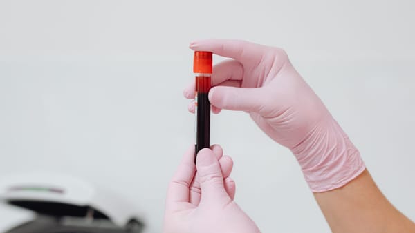 TTG skriningi: barcha bolalar uchun shartmi?