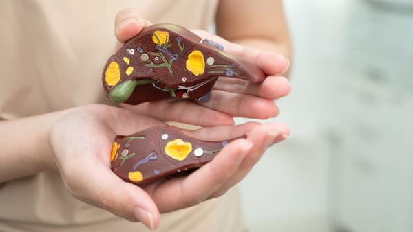 A gepatiti (Botkin kasalligi)