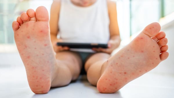 Enterovirus va ichak infektsiyalari mavsumi: